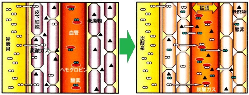 高濃度炭酸泉の期待できる効果